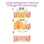 Фотоепилатор Beurer IPL 5800 PureSkin Pro Hair-remover